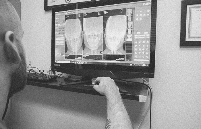 Precision 3D Upper Cervical Imaging